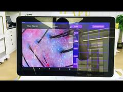 AI Hair Analyzer Machine